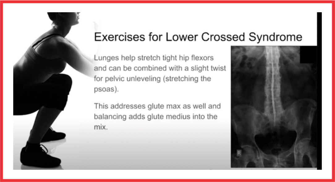 Exercises-for-Lower-Cross-Syndrome – Liberation